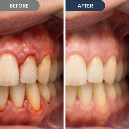 🏆 Official Store |SmileFitPro™ Precision Gum Care Gel